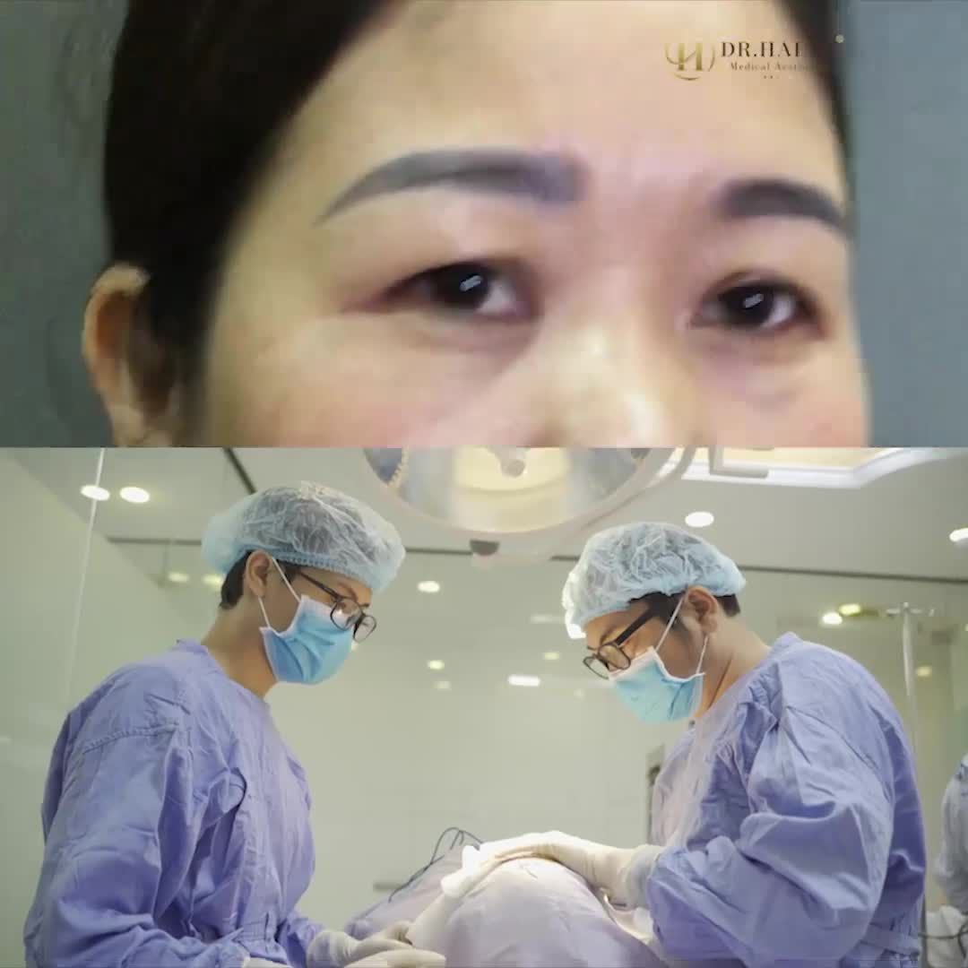 "Chị em nào muốn làm đẹp, cứ đến Dr.Hải Lê....an tâm lắm" review cực kì dễ thương của chị gái sau khi nâng cung mày tại Dr.Hải Lê.