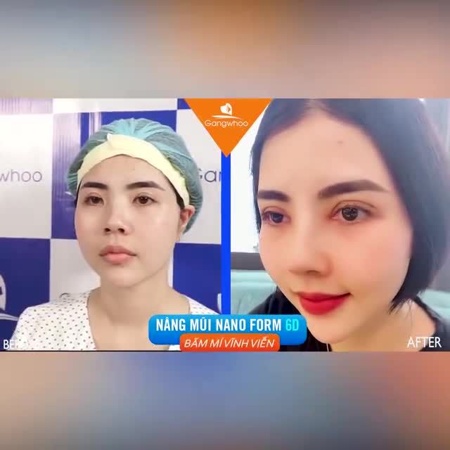 CHỊ KHÁCH “KIẾN TẠO” VẺ ĐẸP THẦN THÁI, SANG TRỌNG KHI ĐẾN VỚI DR.PARK