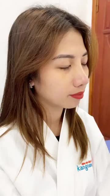 Chỉ NÂNG MŨI mà thay đổi THẦN SẮC đến khó tin