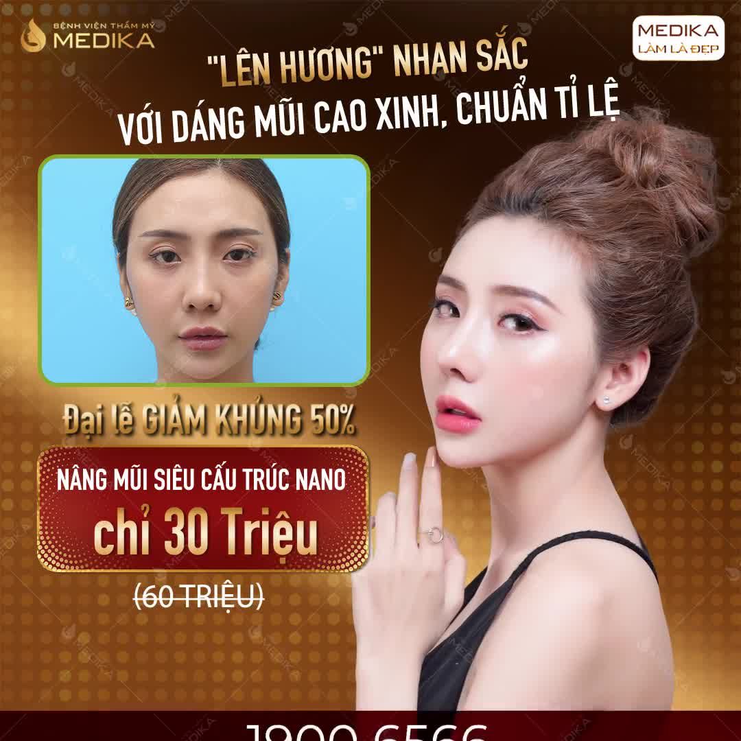 CHỈ nâng mũi SIÊU CẤU TRÚC NANO mà "lột xác" thành hotgirl luôn