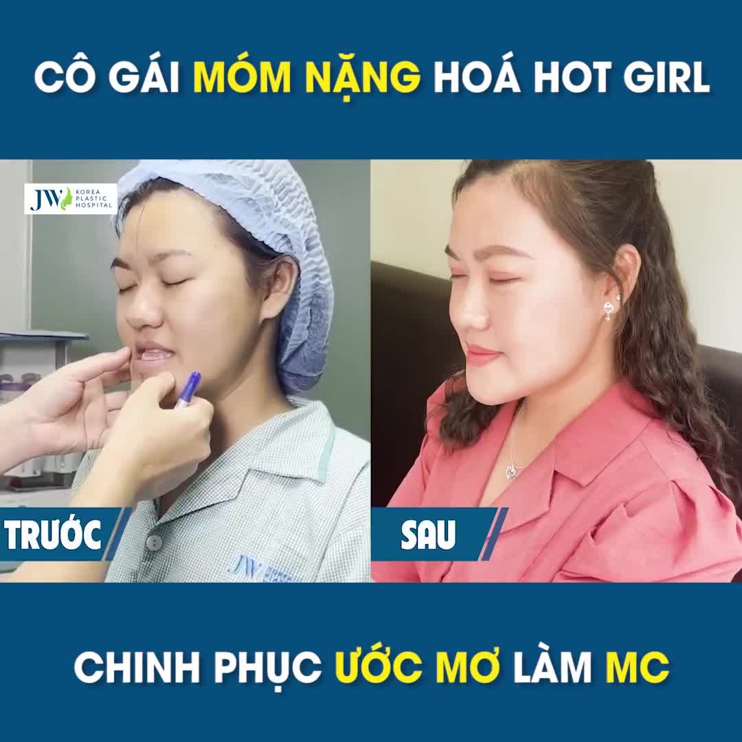 Cô gái quyết tâm phẫu thuật HÀM MÓM, chinh phục ƯỚC MƠ làm MC