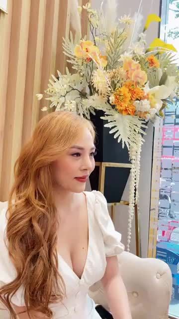 Cô nàng xinh đẹp sau 1 tháng nâng mũi - khắc phục đầu mũi cụp