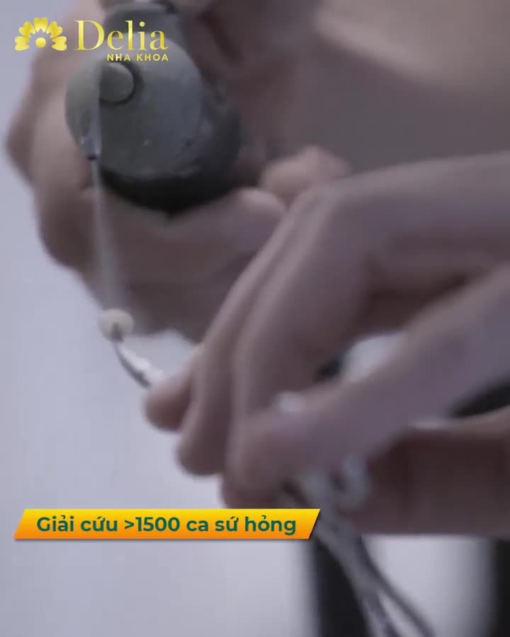Công nghệ răng sứ BIO INVIO 3I - Đầu tư một lần, tự tin một đời