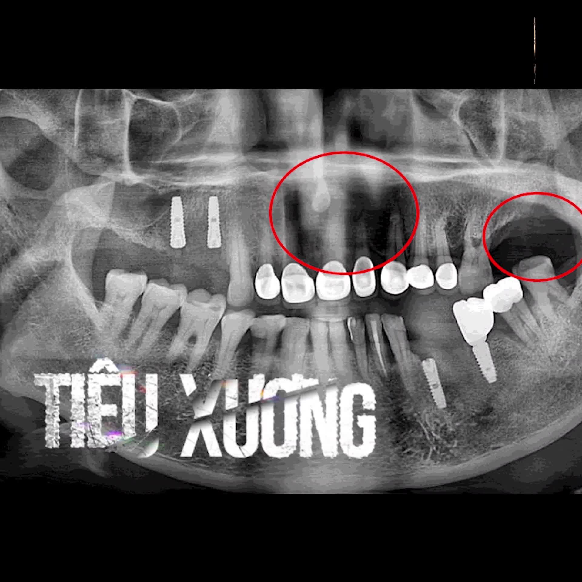 ĐÃ BAO LÂU RỒI BỐ MẸ BẠN KHÔNG ĐƯỢC ĂN NGON MỘT CÁCH ĐÚNG NGHĨA???