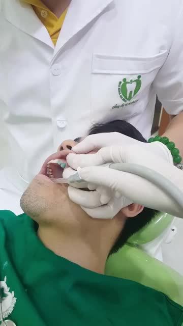 DÁN SỨ VENEER SIÊU MỎNG CHO MỘT VỊ KHÁCH HÀNG NAM