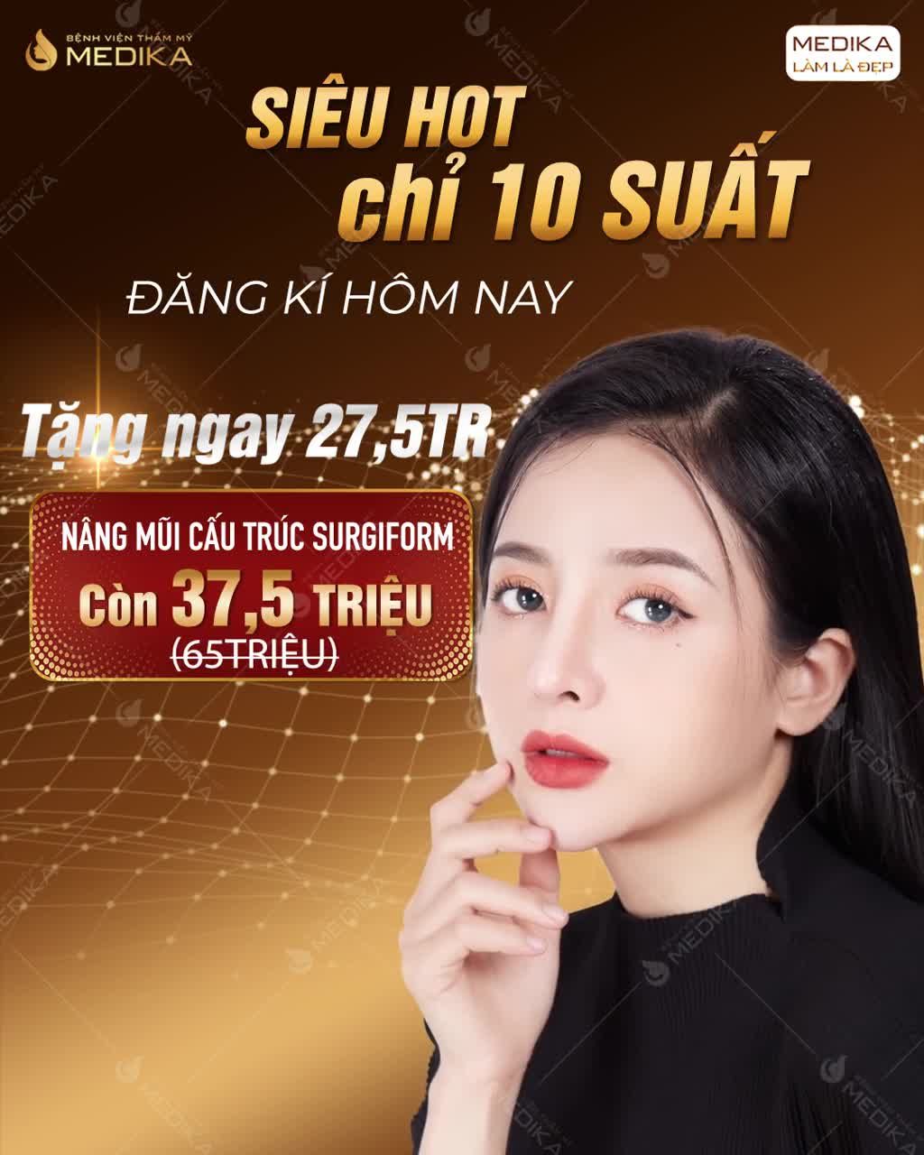 ĐẲNG CẤP MŨI ĐẸP CHỈ CÓ THỂ LÀ NÂNG MŨI CẤU TRÚC SURGIFORM
