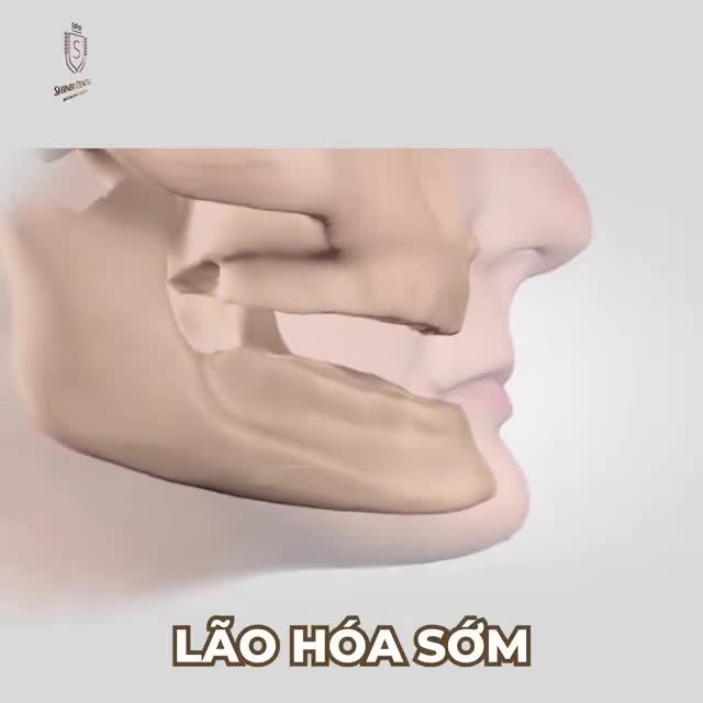 ĐỂ MẤT RĂNG KHÔNG CÒN LÀ NỖI LO!!!