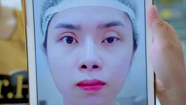 Deeptech - Giải cứu mí lỗi hỏng tại cơ sở không uy tín.