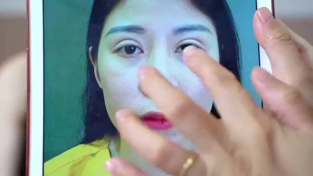 Đến Dr.Hải Lê sửa lại mí em như trút được gánh nặng sau nhiều lần làm mí hỏng? chia sẻ của vị khách hàng sau khi Sửa mí DeepTech thành công tại Dr.Hải Lê