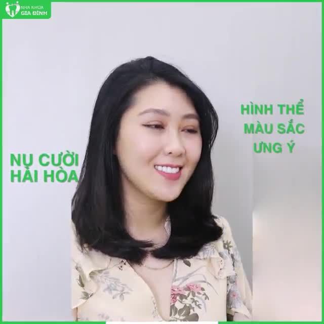ĐIỂM SÁNG NHẤT TRÊN GƯƠNG MẶT CHÍNH LÀ NỤ CƯỜI