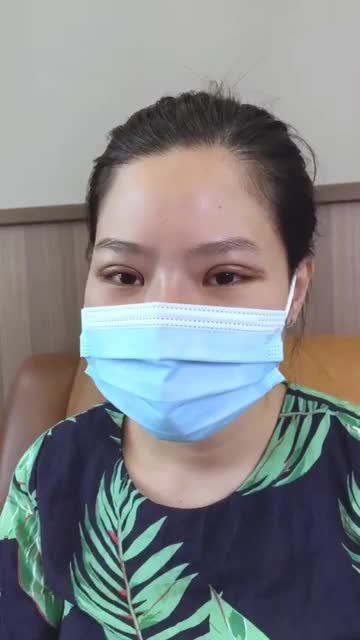 Đôi mắt MK1 sau 7 ngày cắt chỉ sẽ như thế nào? Mời mọi người cùng chiêm ngưỡng.