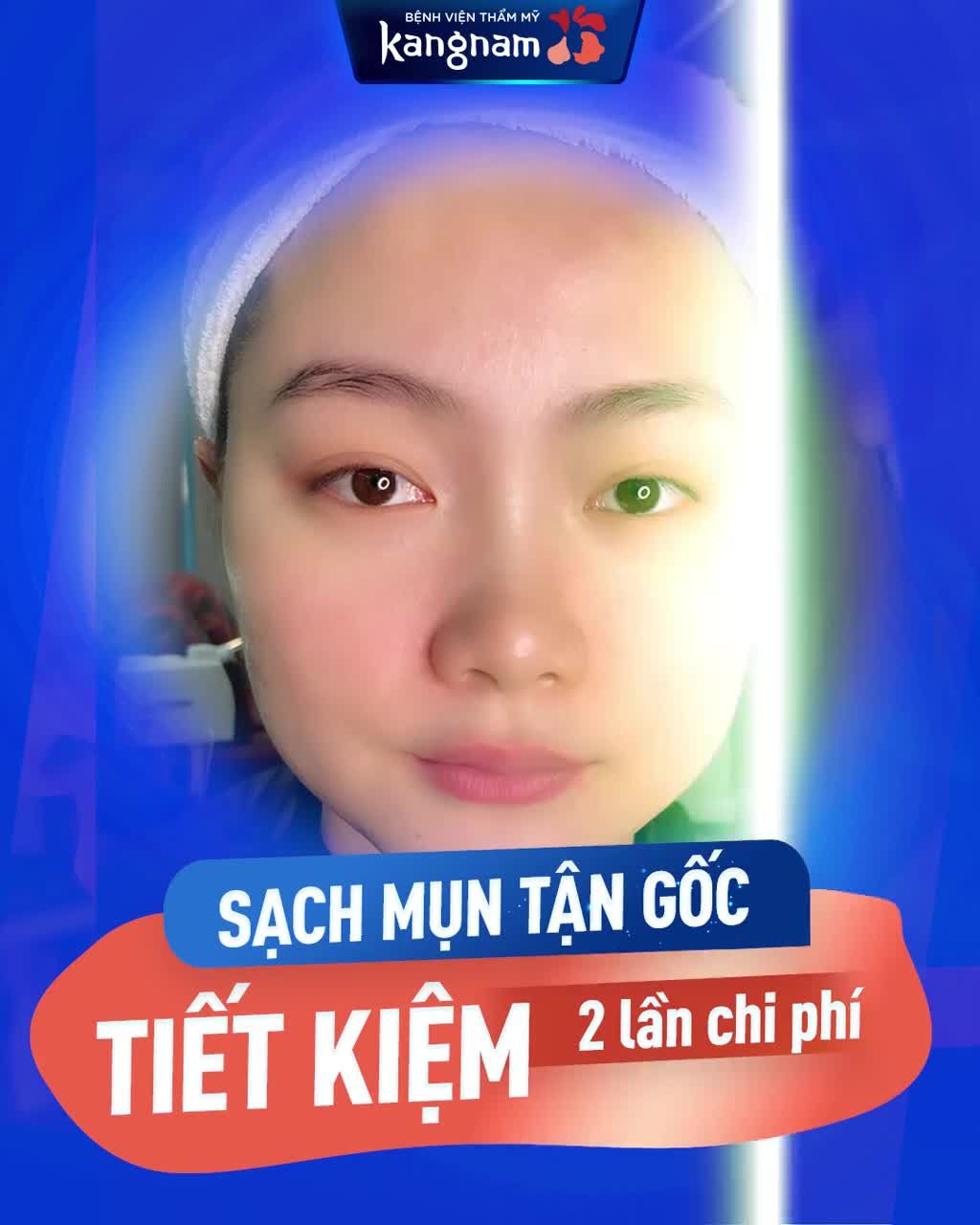 Dọn sạch mụn mủ viêm đầu đen mụn ẩn thâm mụn