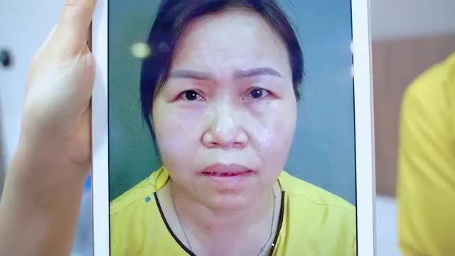 Dr.Hải Lê giúp nhiều khách hàng có được đôi mắt rạng rỡ, trẻ trung trả lại vài năm tuổi xuân như thế nào? Theo dõi video ngay