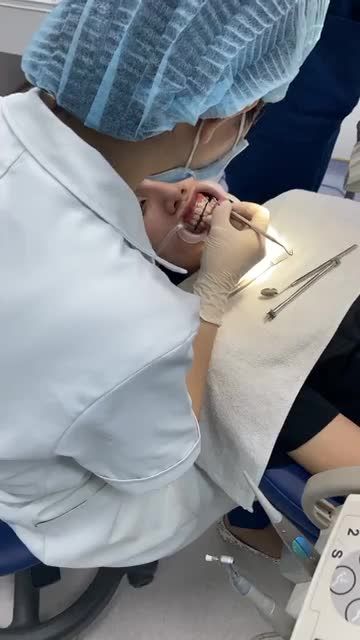 Gắn mắc cài kim loại thường cho khách hàng tại Kim Mã