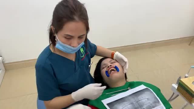 GẮN MẮC CÀI TẠI NHA KHOA THÙY ANH CHO BẠN KHÁCH HÀNG VỚI TÌNH TRẠNG RĂNG HÔ,LỆCH LẠC NẶNG.