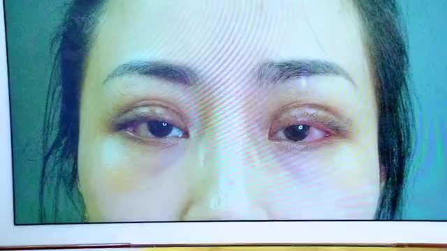 GIẢI CỨU MÍ HỎNG THỜI ĐIỂM VÀNG TỪ 0-14 NGÀY SAU CẮT MÍ HỎNG TẠI CƠ SỞ KHÔNG UY TÍN