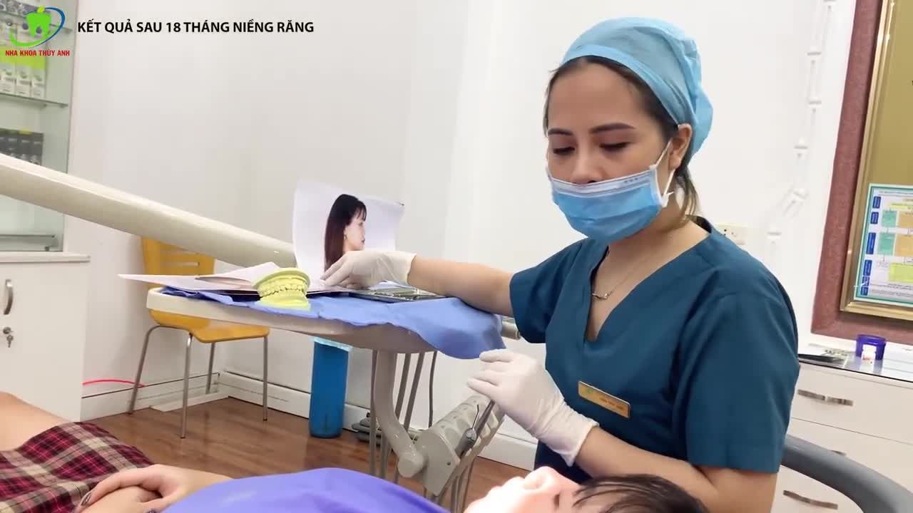 GIẢM HÔ HIỆU QUẢ NHỜ NIỀNG RĂNG - SỰ THAY ĐỔI SAU 18 THÁNG ĐEO NIỀNG