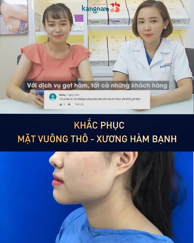 GỌT HÀM sợ đau - Bao lâu thì lành?