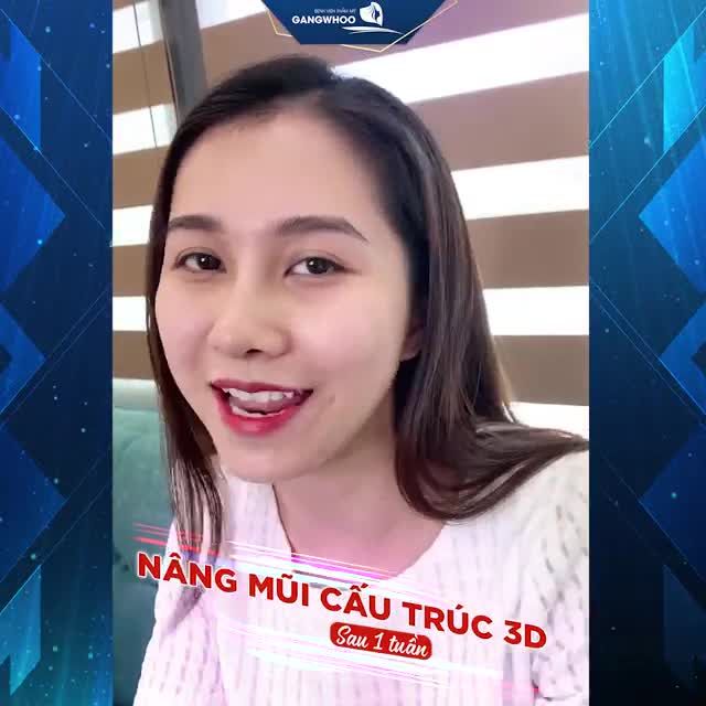 “HẬU QUẢ NGHIÊM TRỌNG”: MŨI ĐẸP ẤN TƯỢNG, KHÔNG TỲ VẾT