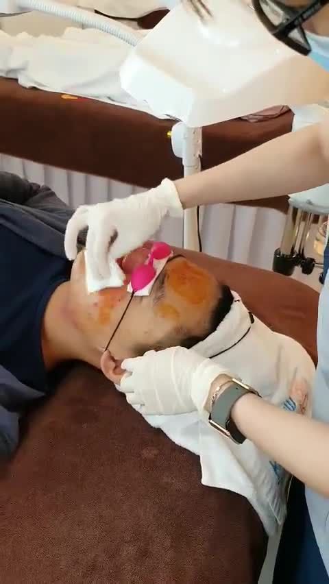 Hè chói chang - Da dầu càng thêm dầu, da mụn càng thêm mụn