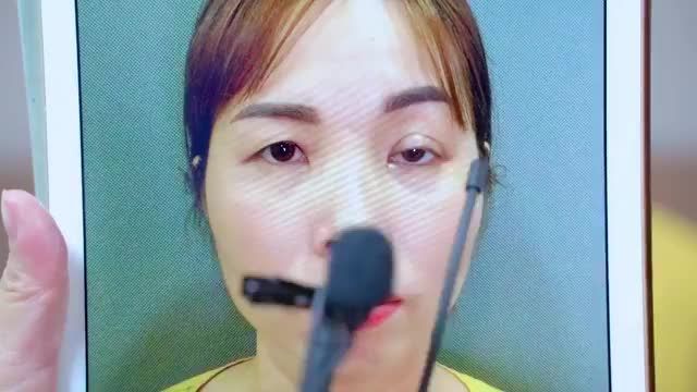 Hệ lụy từ cắt mí hỏng  Đứt cơ nâng mi gây liệt cơ, đau mắt nhức mỏi, giảm thị lực... Cùng theo dõi kết quả Sửa mí thành công tại Dr.Hải Lê