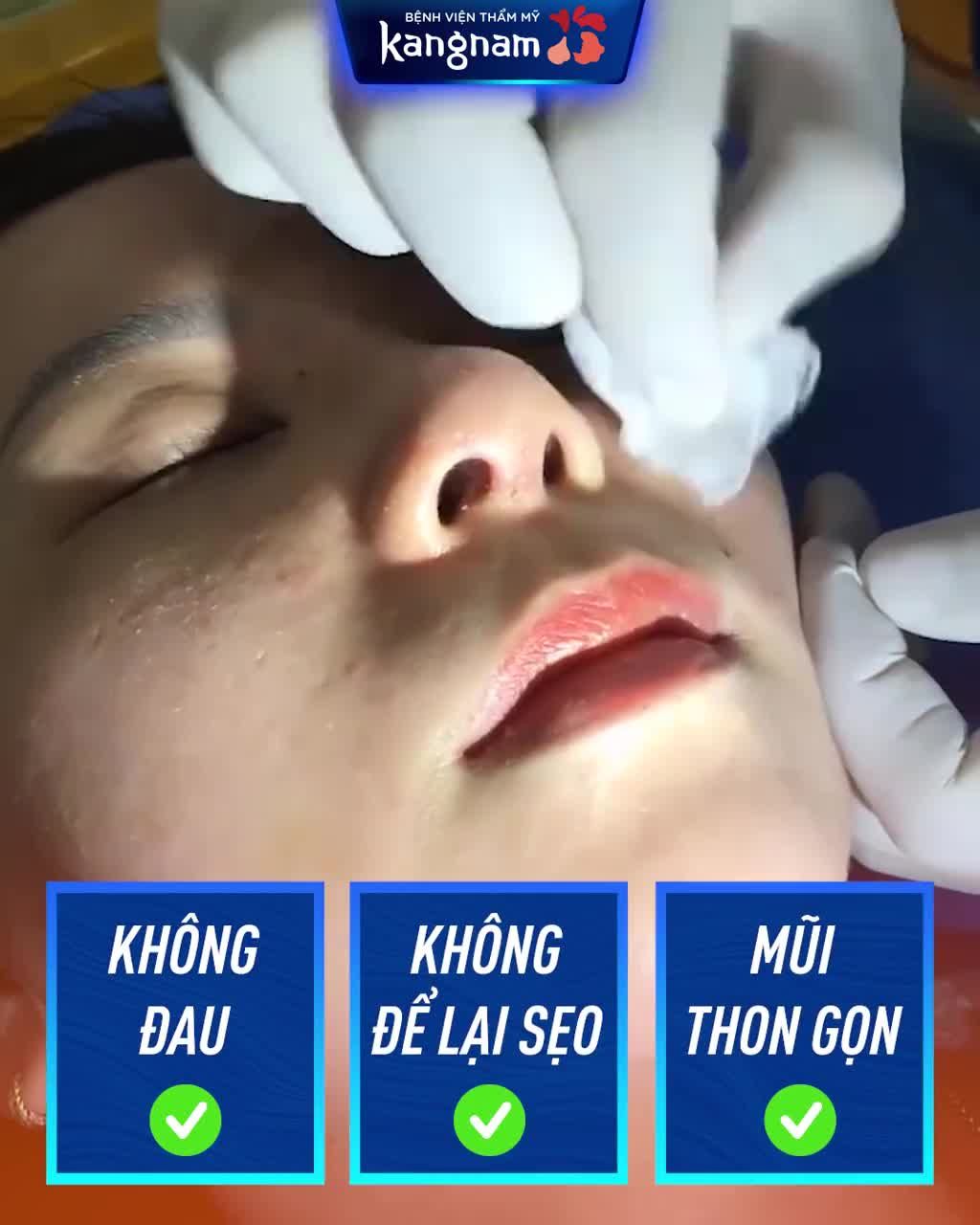 Hết thời MŨI TO BÈ kém sang