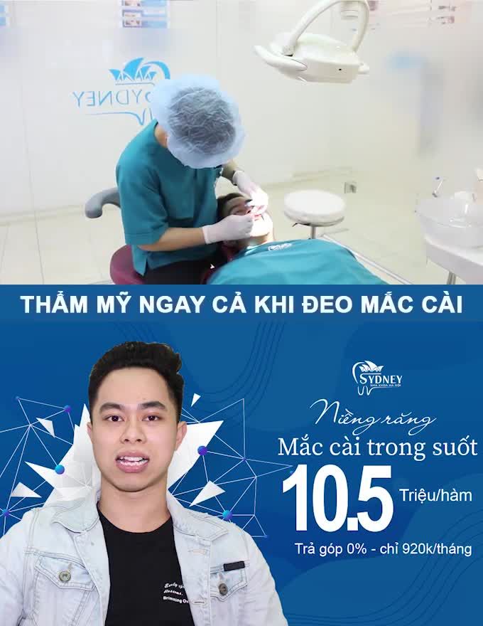 Hiệu quả chỉnh nha với các trường hợp răng hô, móm, khấp khểnh, khe thưa
