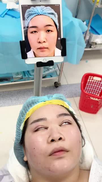 Hoàn thành Ca Cắt Mí và Mở góc trong cho khách hàng