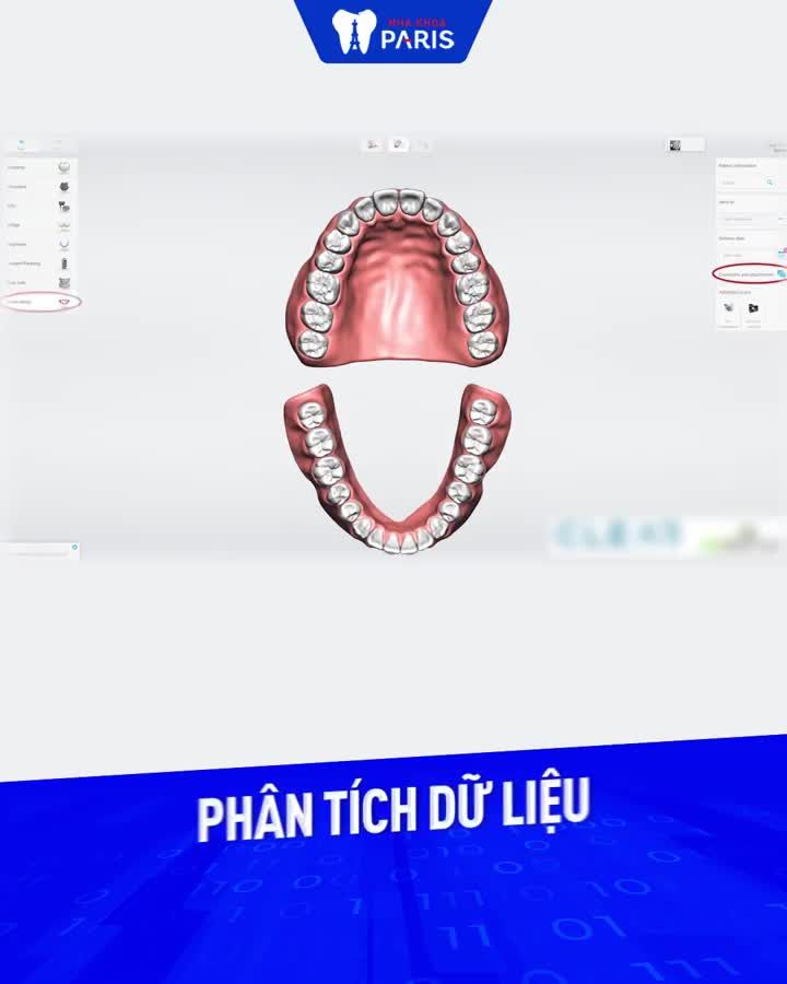 HOTTT! TRIOS 3D - CÔNG NGHỆ NHA KHOA TÂN TIẾN NHẤT TỪ CHÂU ÂU ĐÃ CẬP BẾN TẠI NHA KHOA PARIS