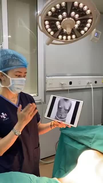 KẾT QUẢ COMBO "TĂNG V1 - GIẢM V2" BỞI EKIP SLINE