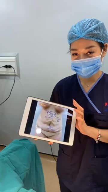 KẾT QUẢ "GIẢI CỨU" HÚT MỠ HỎNG