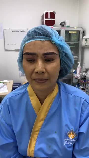 Kết Quả Nâng Cung Mày Sau 30 Phút Tại Bệnh Viện Thẫm Mỹ Đông Á.