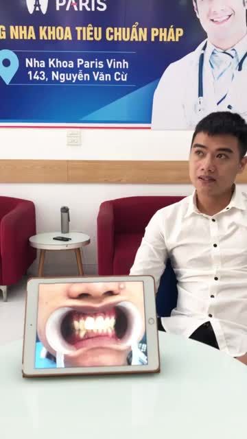 KH Hồ Văn Tuấn vừa thực hiện dịch vụ gắn 4 răng sứ Bio của Đức tại nha khoa Paris do bs Huyền cùng ekip Vinh thực hiện!!
