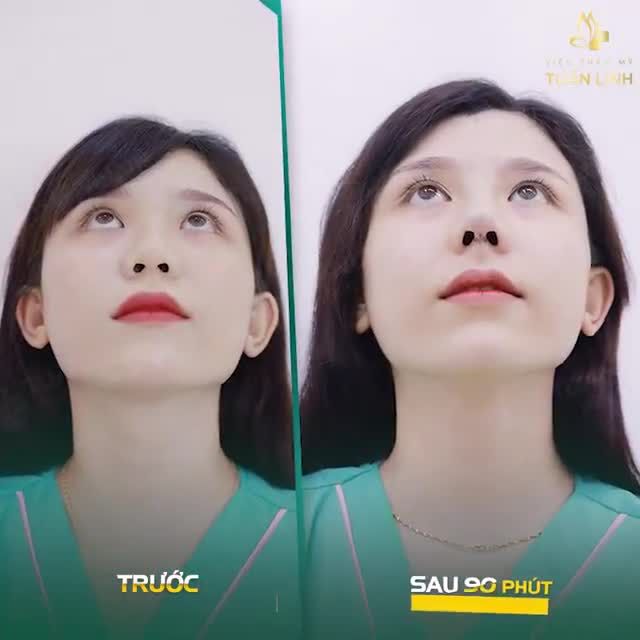KH KIM CƯƠNG - TRÚNG GIẢI NÂNG MŨI ĐẤU GIÁ 0 ĐỒNG SỐ ĐẦU TIÊN.