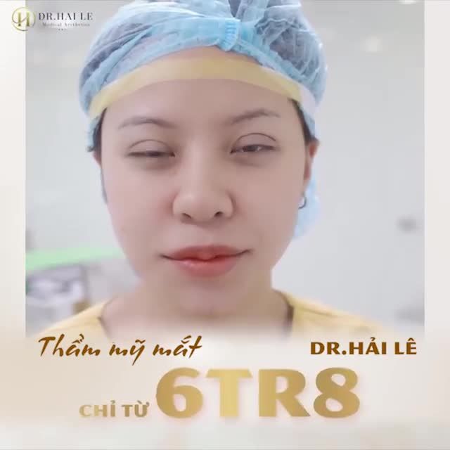 Khách hàng cắt mí