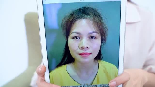 Khách hàng nói gì sau 7 ngày Cắt mí tại Dr.Hải Lê Cùng theo dõi để có thêm kinh nghiệm thẩm mỹ mắt bạn nhé