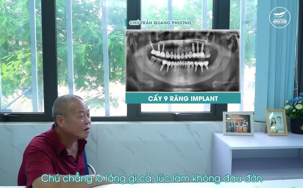 KHÁCH HÀNG NÓI GÌ SAU KHI CẤY IMPLANT TẠI SMILE ONE