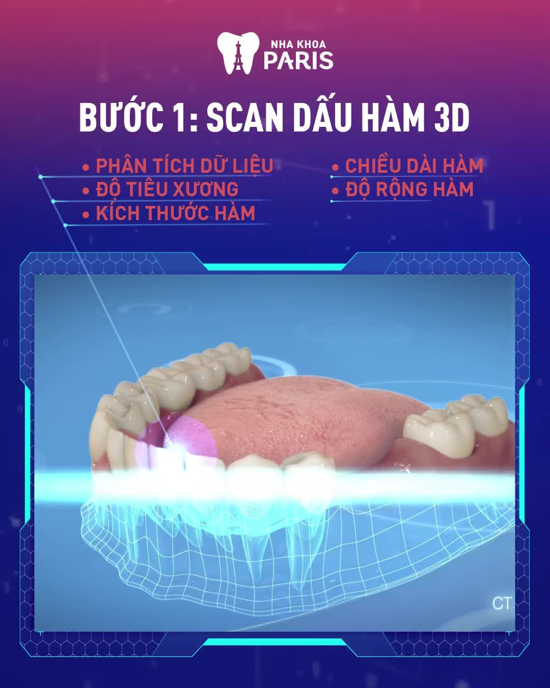 Khôi phục răng mất sau 5 ngày