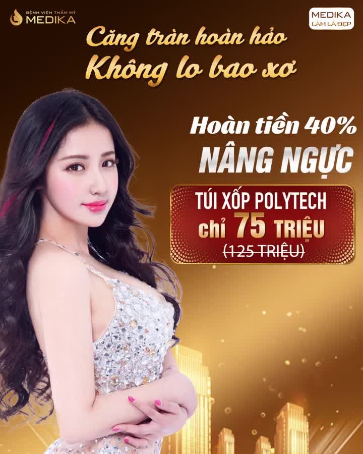 KHÔNG LO BAO XƠ - KHÔNG LO BIẾN CHỨNG