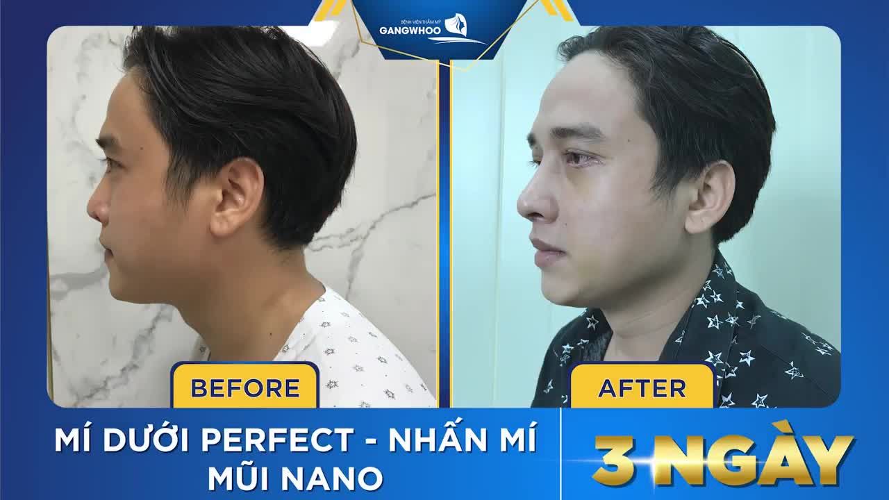 LÀM ĐẸP CÙNG DIỄN VIÊN THÁI ĐÌNH DƯƠNG