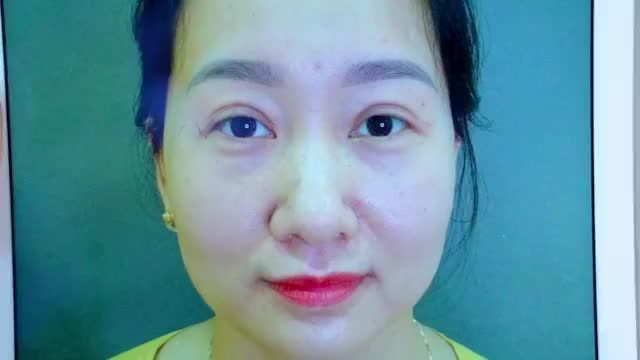 "Làm mí ai cũng mong đẹp hơn, còn tôi làm mí xong bị hỏng chỉ mong đến ngày bình phục để đi sửa" Trải lòng của vị khách hàng sau 3 tháng làm mí hỏng tại cơ sở không uy tín chờ đợi đủ 3 tháng để sửa lại và nhận được cái kết đúng như mong đợi