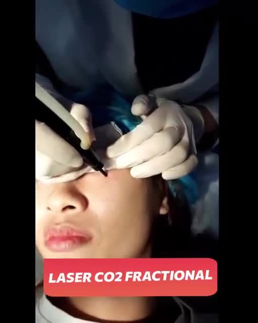 Làn da mịn màng là vũ khí mạnh nhất của phụ nữ. Thế nhưng, chị khách lại đang mất tự tin vì mặt có MỤN THỊT SẦN SÙI