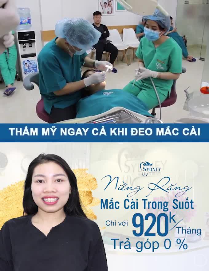 Lợi ích của niềng răng mắc cài pha lê: