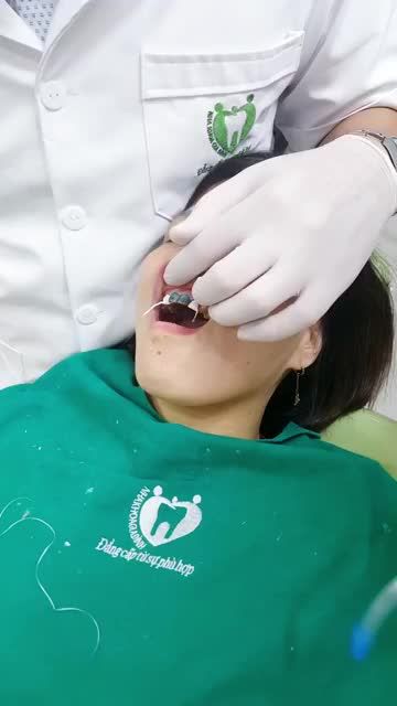 ”LỘT XÁC NỤ CƯỜI” VỚI HÀM RĂNG NHIỄM MÀU KHÁNG SINH NẶNG
