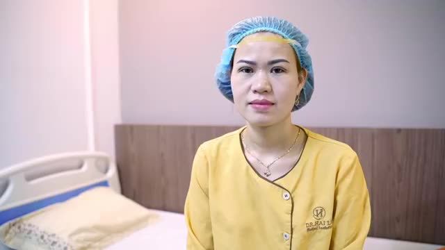 Mắt 1 mí kết hợp mỡ dư nhiều khiến vị khách hàng già đi trước tuổi