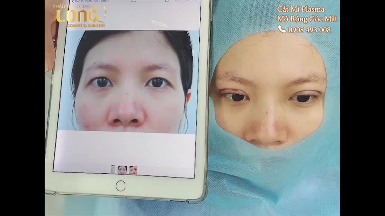 MẮT ĐẸP MÍ XINH RINH NGAY ƯU ĐÃI 10%