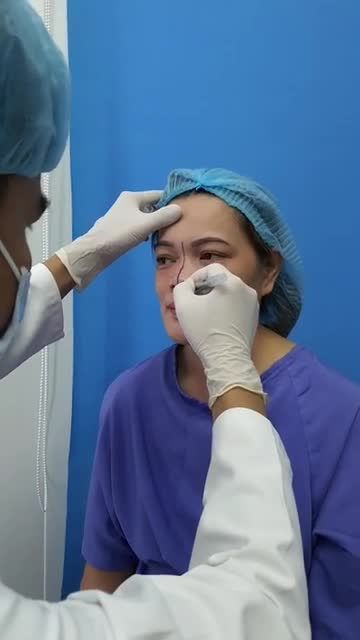 Mặt lệch bẩm sinh được đánh giá CA SIÊU PHỨC TẠP