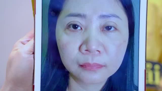 Mắt lỗi hỏng đến mức nào Dr.Hải Lê đều có thể khắc phục lại cho bạn