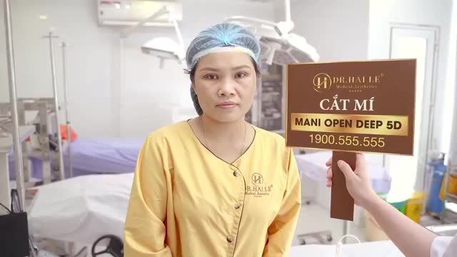 Mắt sụp mí, nhiều bọng mỡ tuổi ngoài 30+ khắc phục như thế nào? Mời quý khách hàng cùng theo dõi