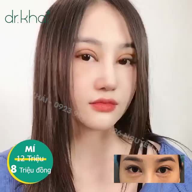 MÍ BÚP BÊ CHỈ VỚI 8 TRIỆU ĐỒNG ƯU ĐÃI TRONG THÁNG 4!